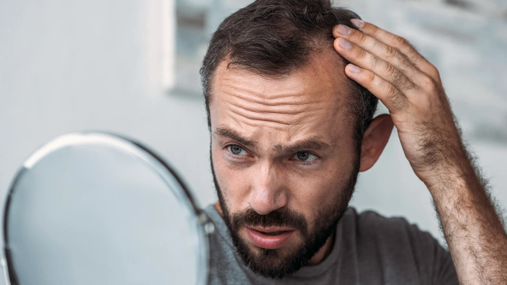 Hair Transplant UK – Your Complete Guide to the Process