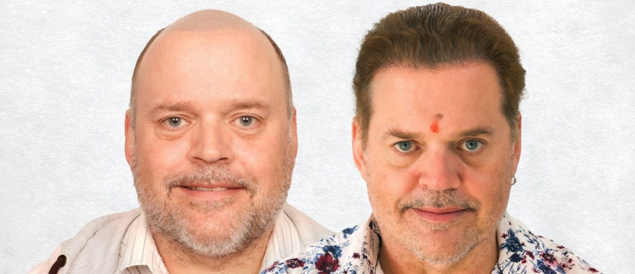 Hair Transplant London – Your Journey to a Fuller, Thicker Hairline